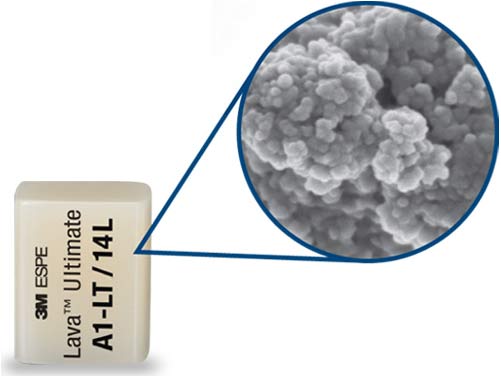 Lava(TM) Ultimate CAD/CAM Restorative new nanotechnology delivers a polish that lasts